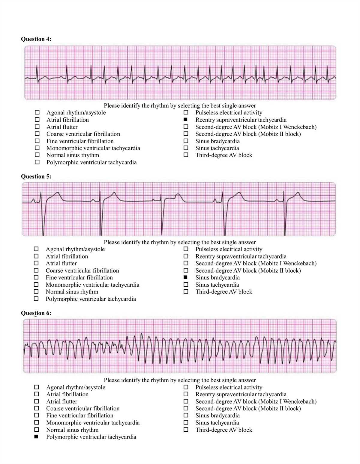 How to interpret ACLS test results?