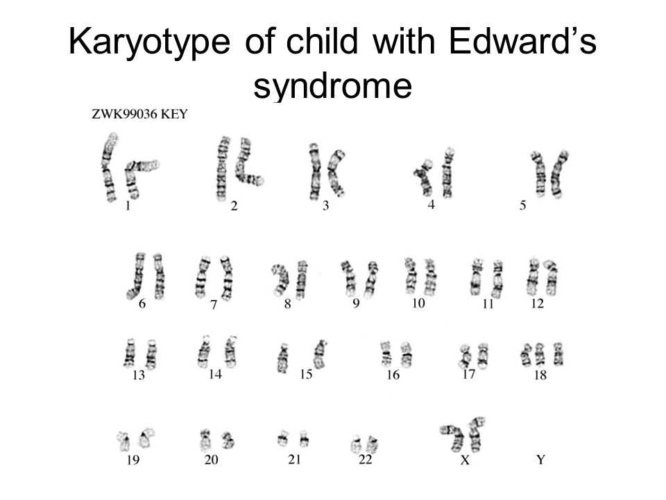 Section 8-1 review chromosomes answer key