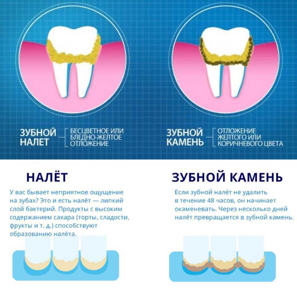 What is Caries Susceptibility?